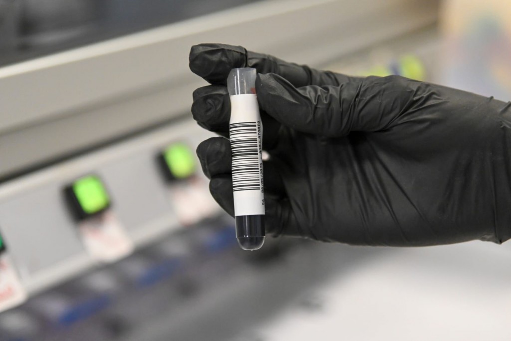 Estudios genéticos de cáncer: Santa Fe es la única provincia que los garantiza en la salud pública y se posiciona como referente nacional